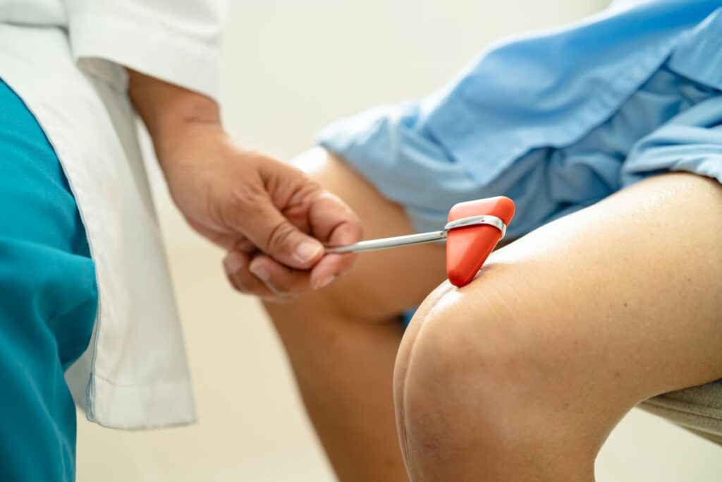 Knee Cap (Patella) Procedure 3 asian doctor use hammer knock senior woman patient 2025 02 25 18 07 31 utc 1