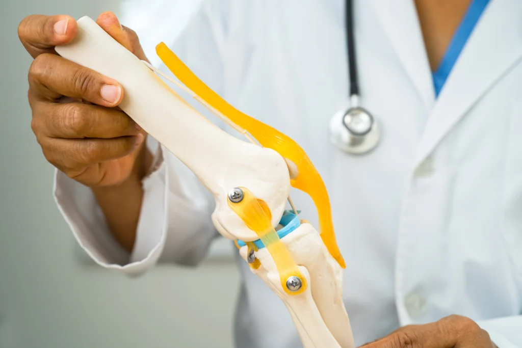 Robotic Assisted Joint Replacement 6 osteoarthritis of the knee doctor holding human k 2024 07 05 05 01 26 utc